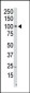 PI4KCB Antibody (N-term)